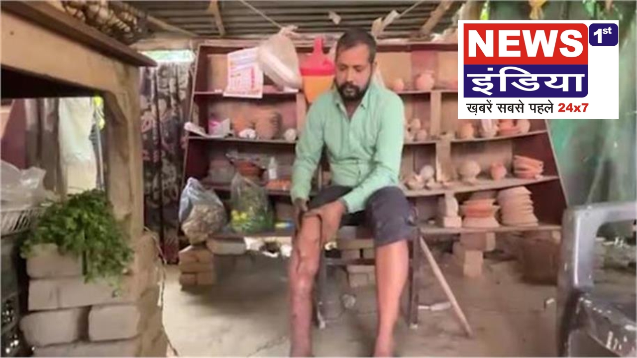 लखनऊ में मेडिकल लापरवाही का दर्दनाक मामला, गलत इलाज से युवक बना अपाहिज